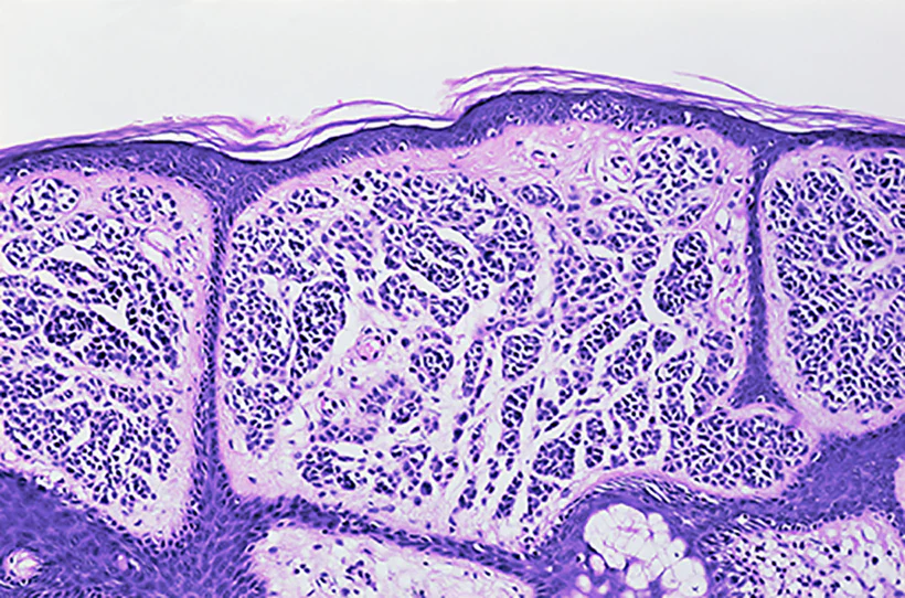 Skin and aesthetics research peptides